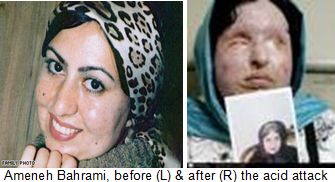 honor killing Ameneh-Bahrami-Iran-acid-attack-victim