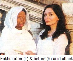 Fakhra-acid-attack-victim-pakistan
