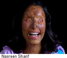 Nasreen-Sharif-acid-attack-victim