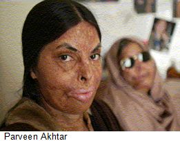 Parveen-Akhtar-acid-attack-victim
