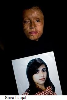 Saira-liaqat-acid-attack-victim